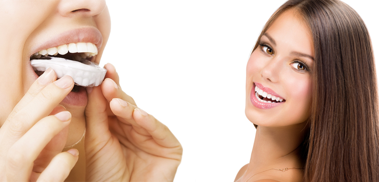dental whitening dental group brooklyn ny